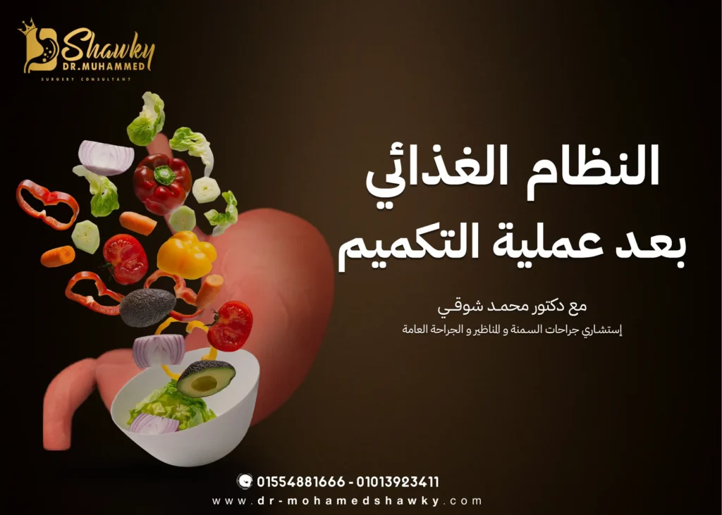 النظام الغذائي بعد عملية التكميم