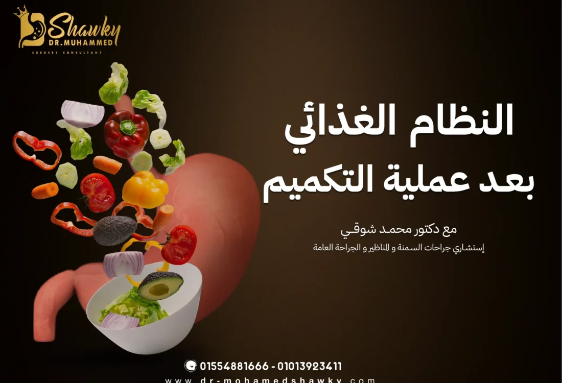 النظام الغذائي بعد عملية التكميم