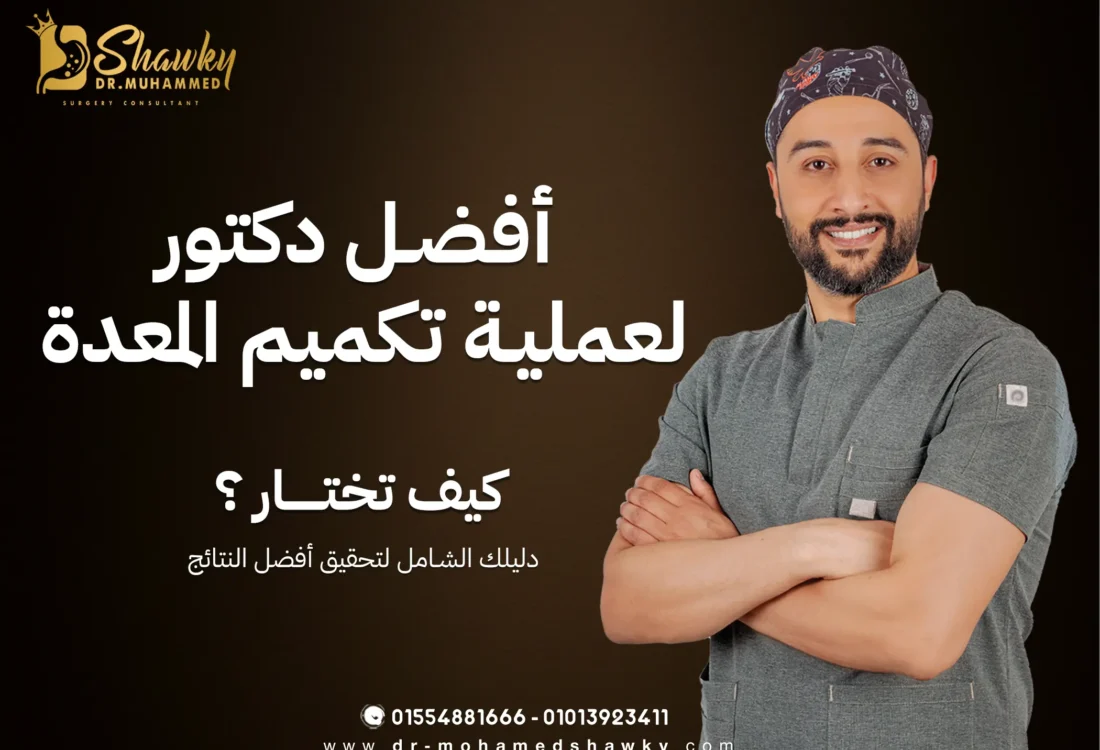 كيف تختار أفضل جراح لتكميم المعدة